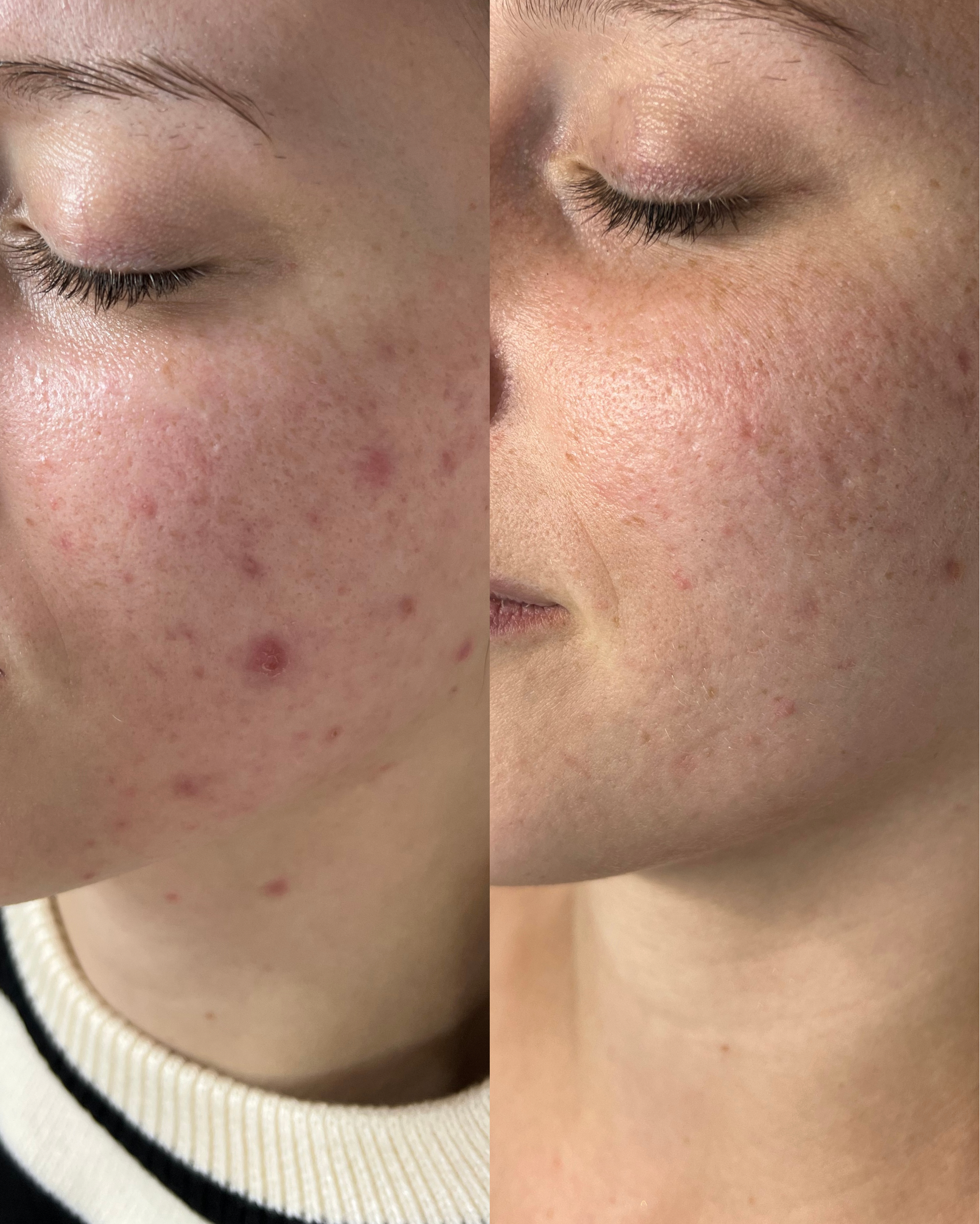 Antes e depois — caso 10