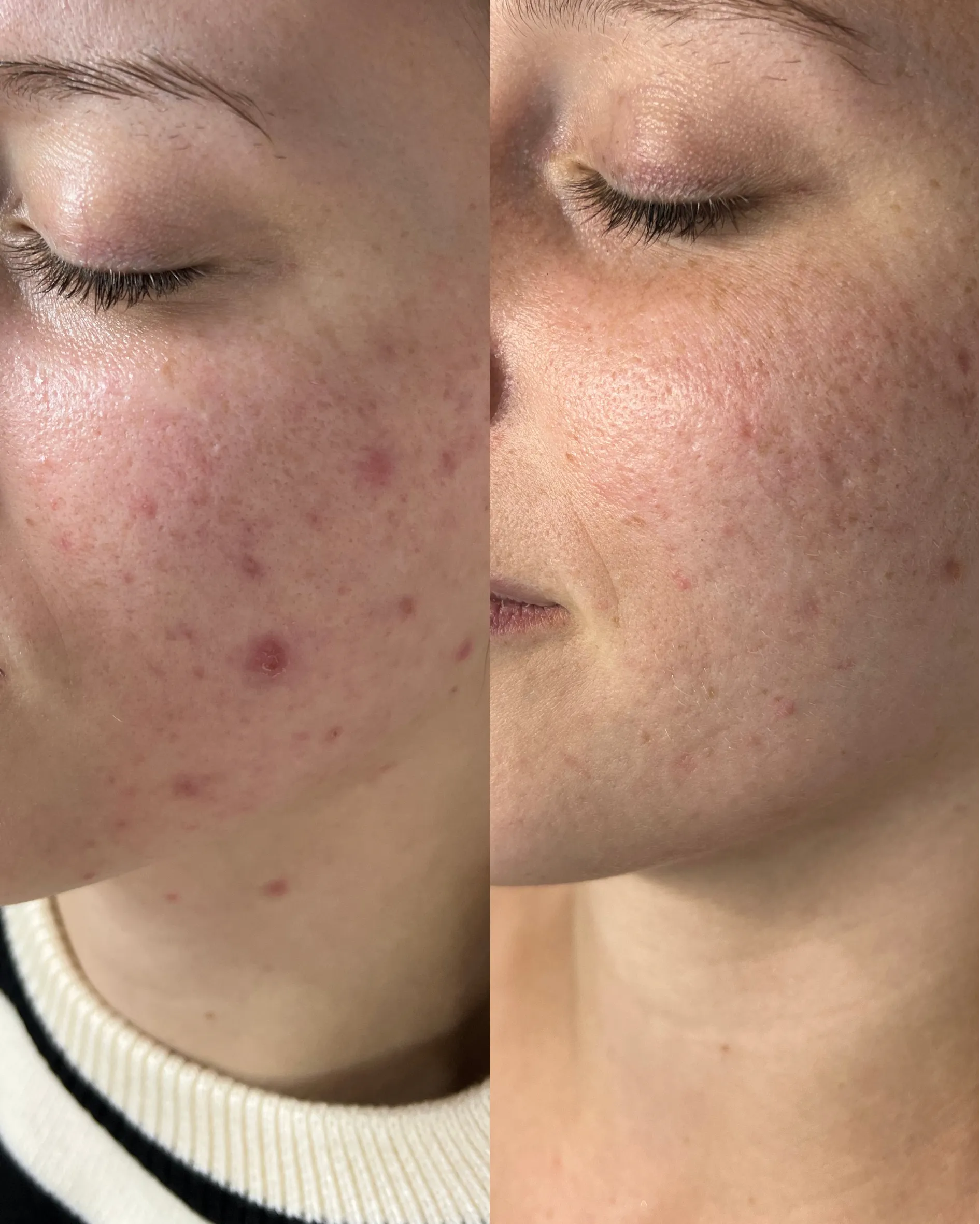 Antes e depois — caso 10