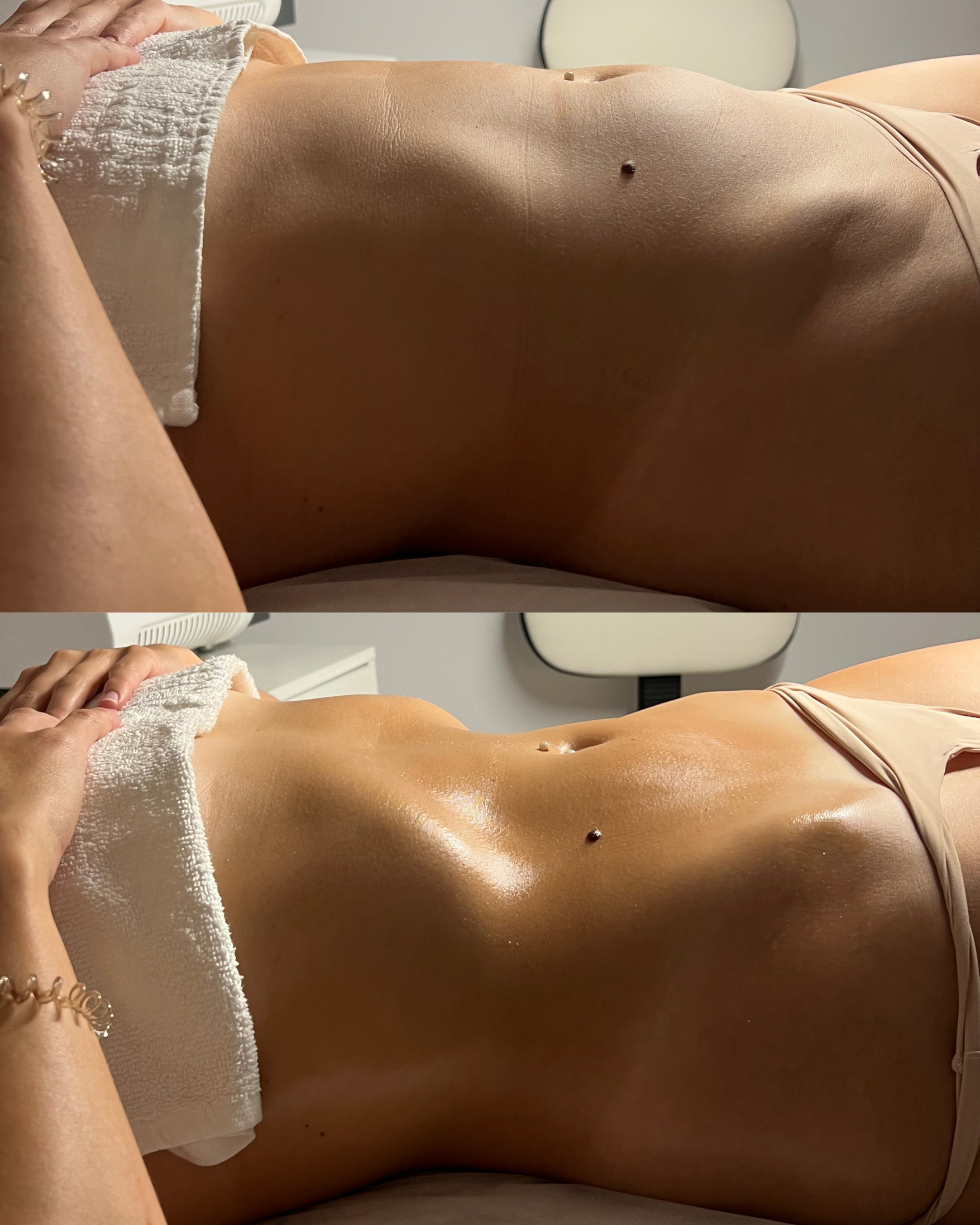 Antes e depois — caso 11