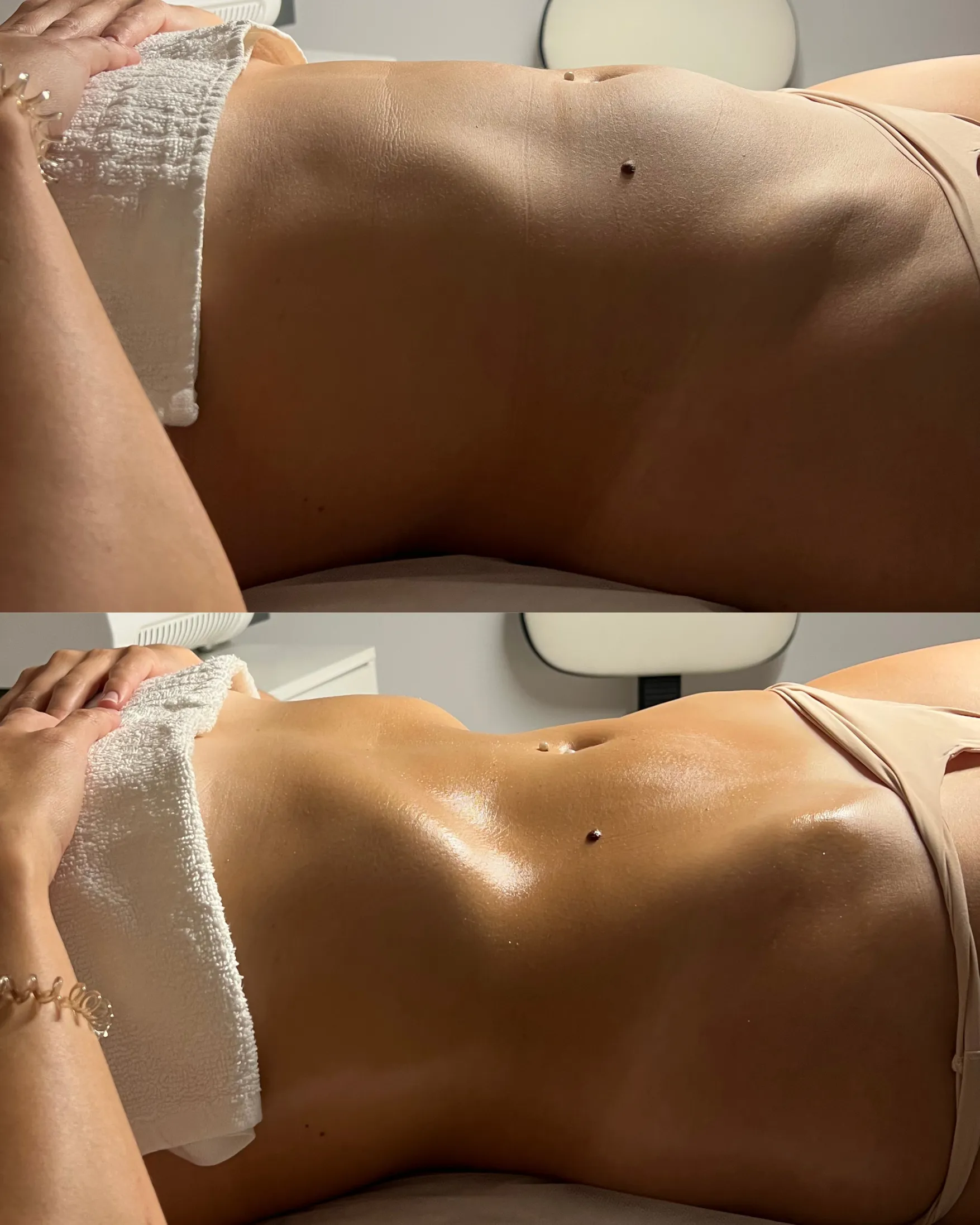 Antes e depois — caso 11
