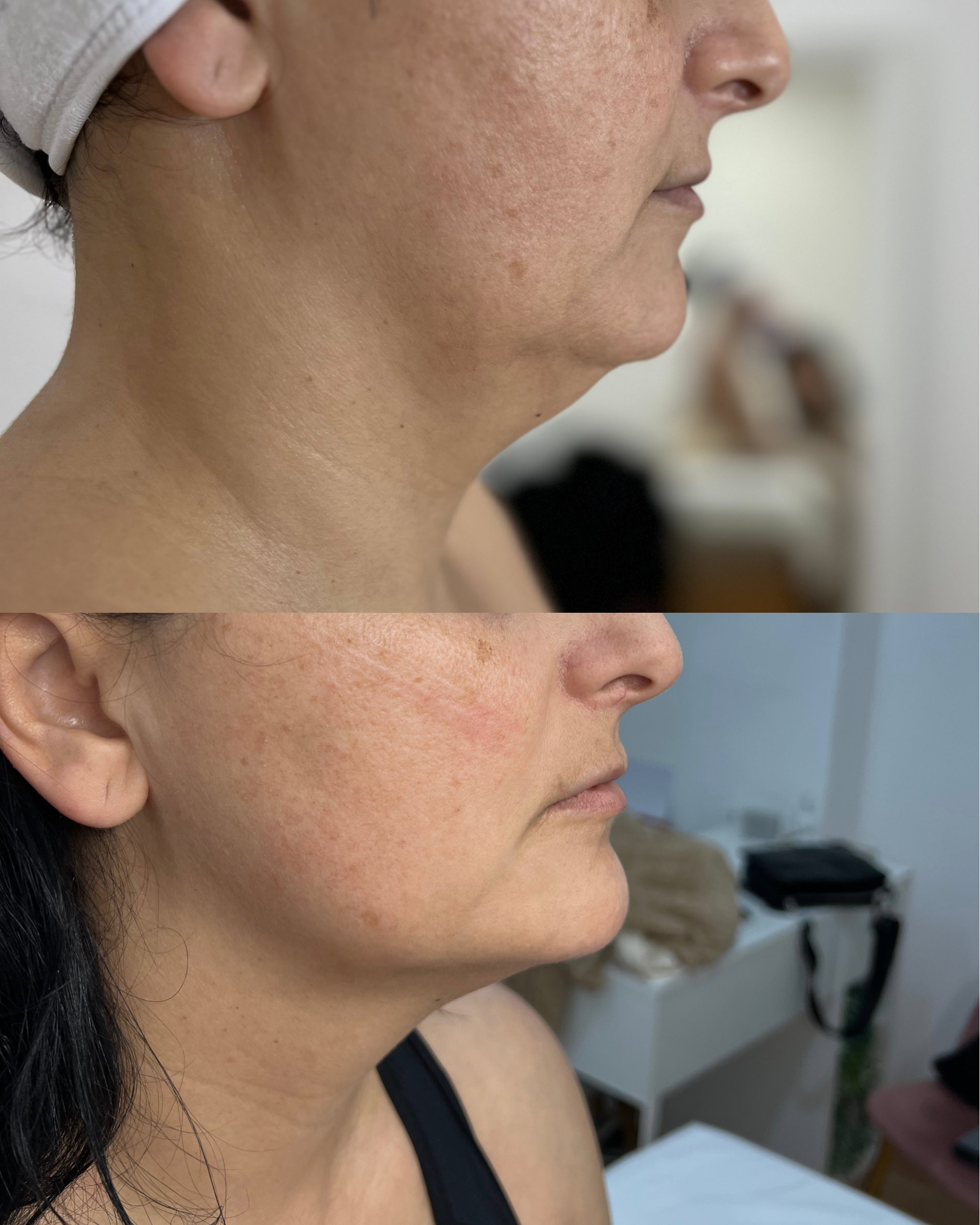 Antes e depois — caso 12