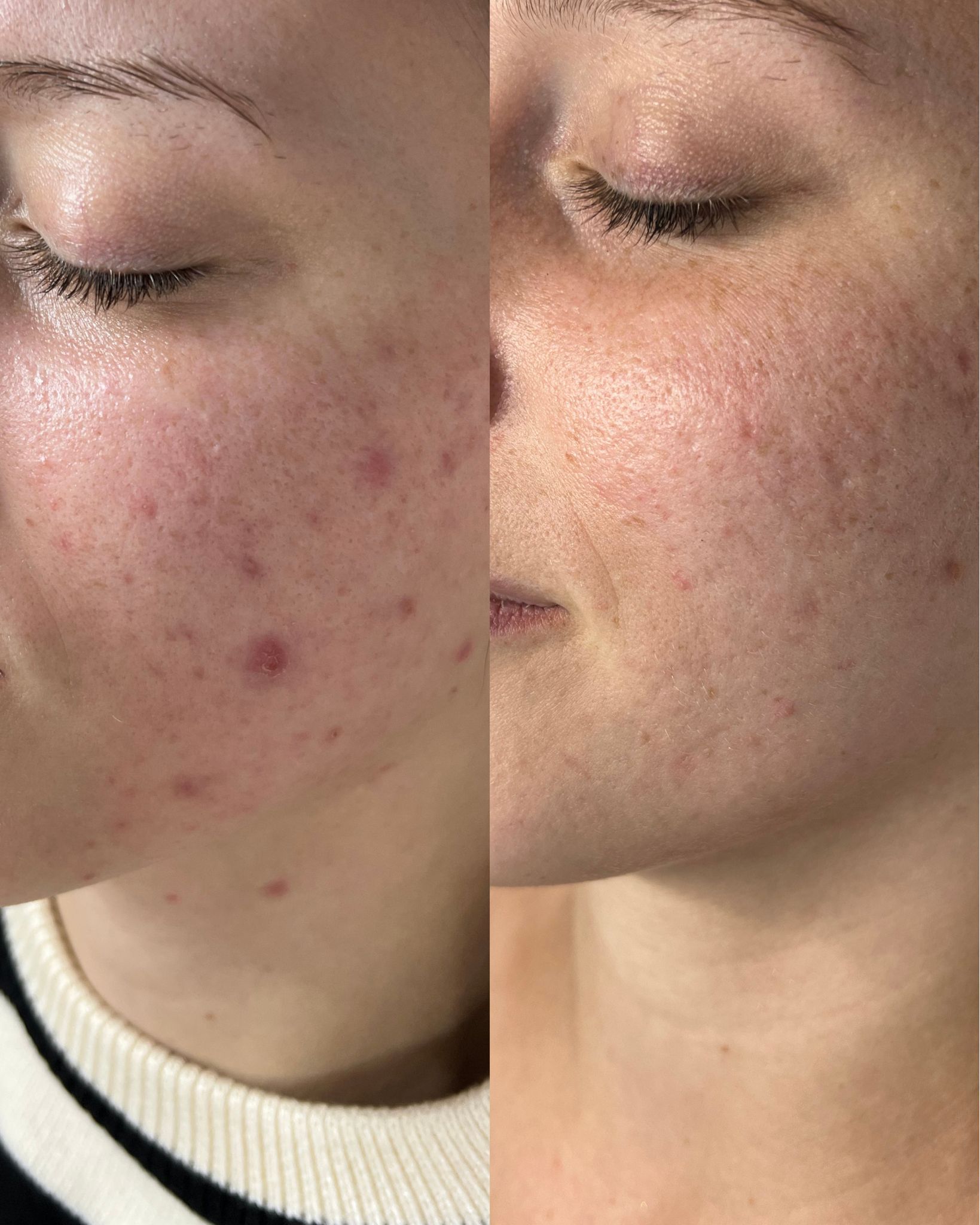 Antes e depois — caso 16