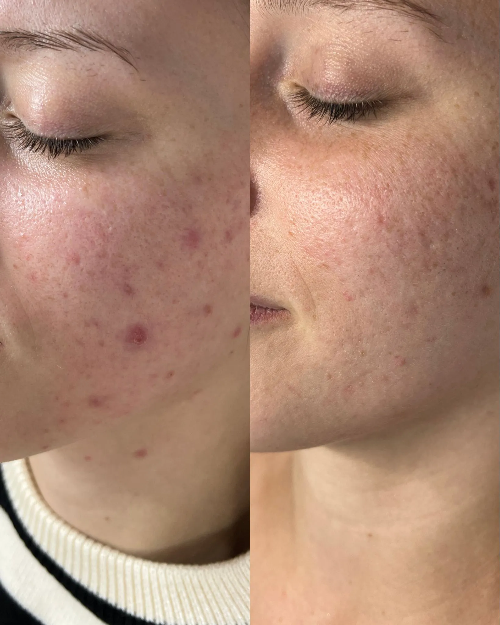 Antes e depois — caso 16