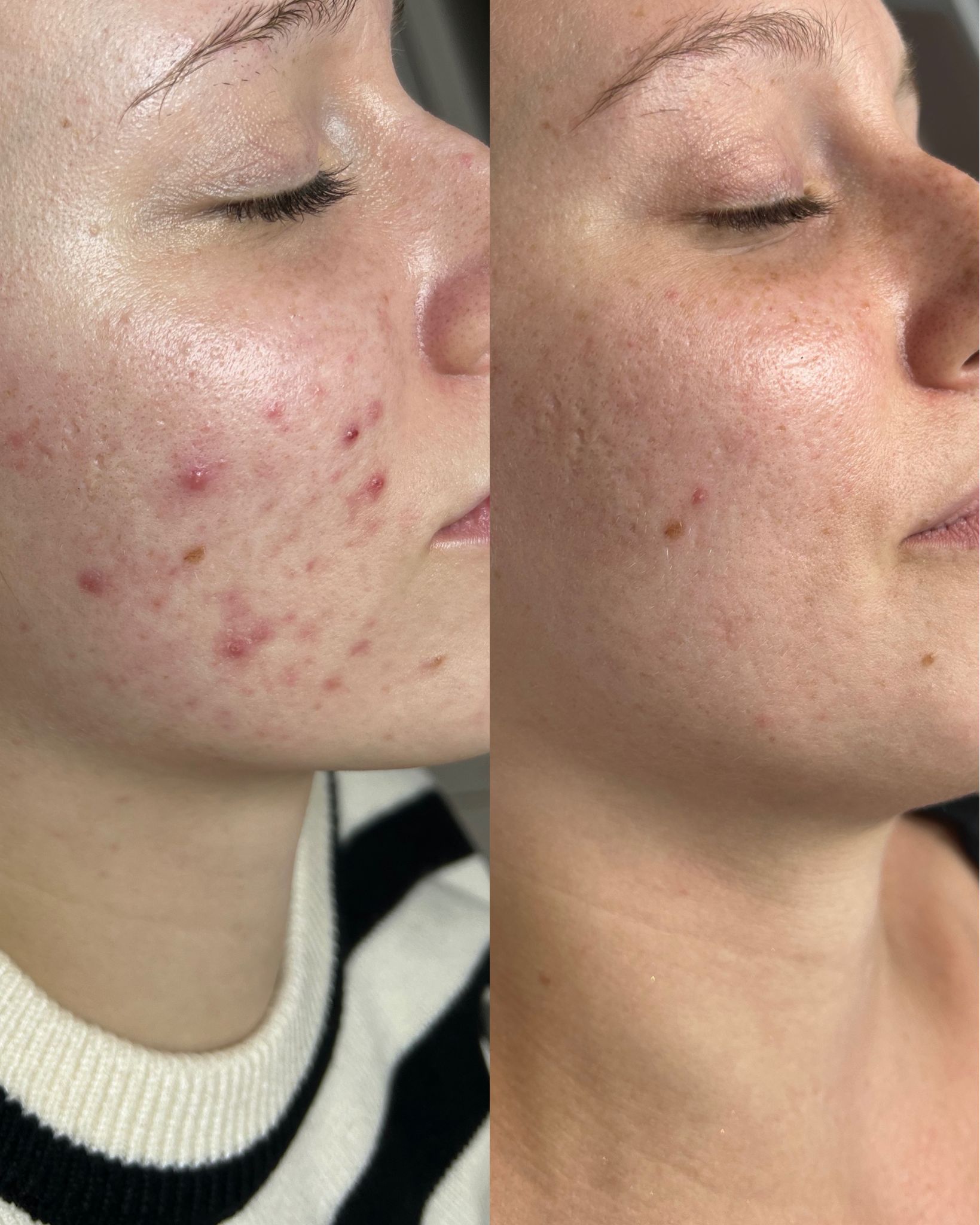 Antes e depois — caso 17