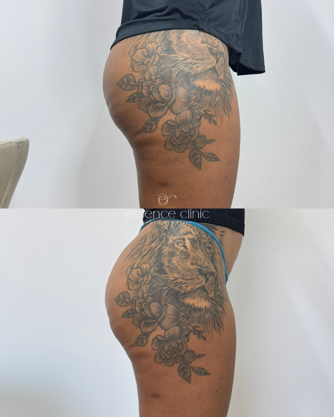 Antes e depois — caso 21