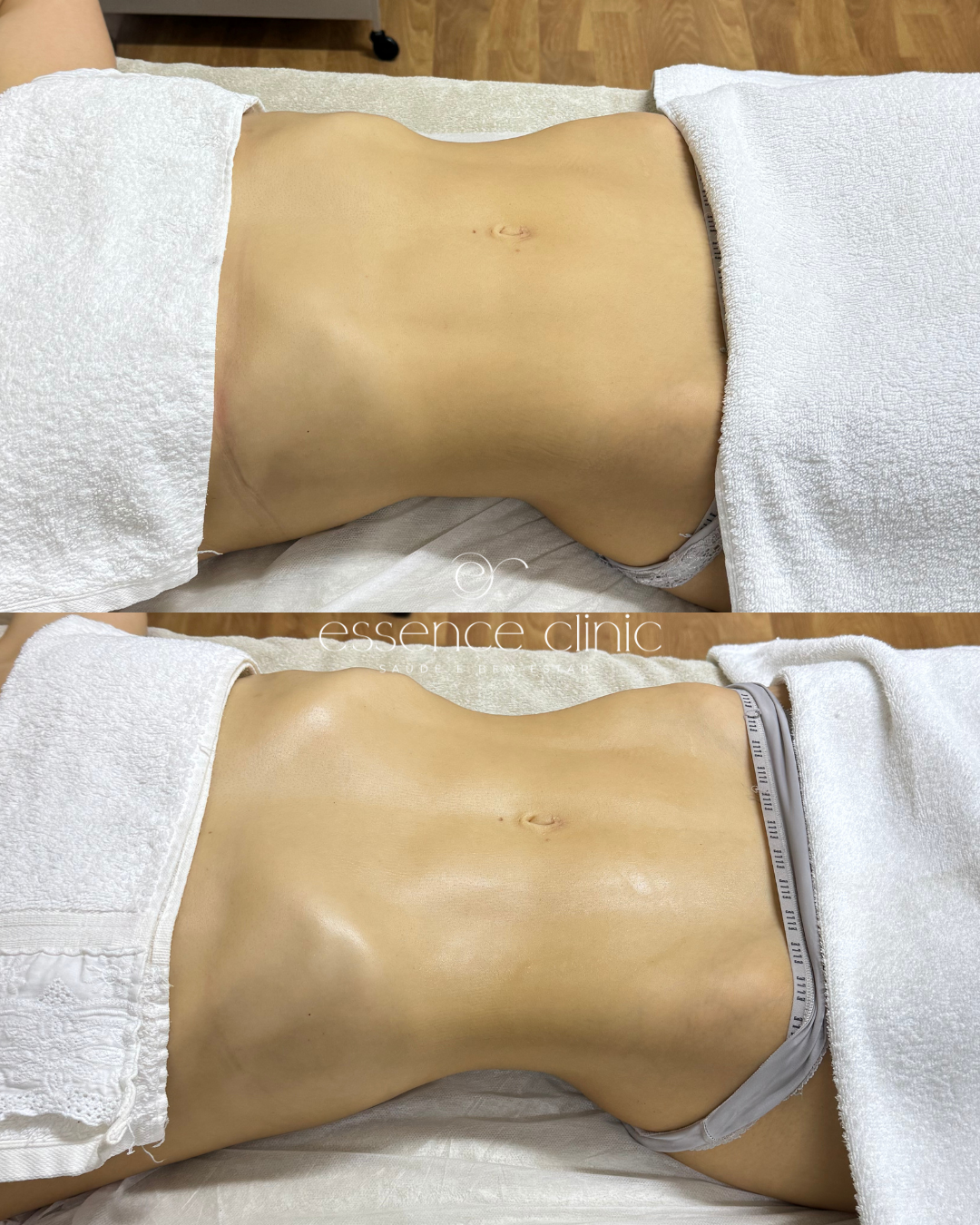 Antes e depois — caso 24