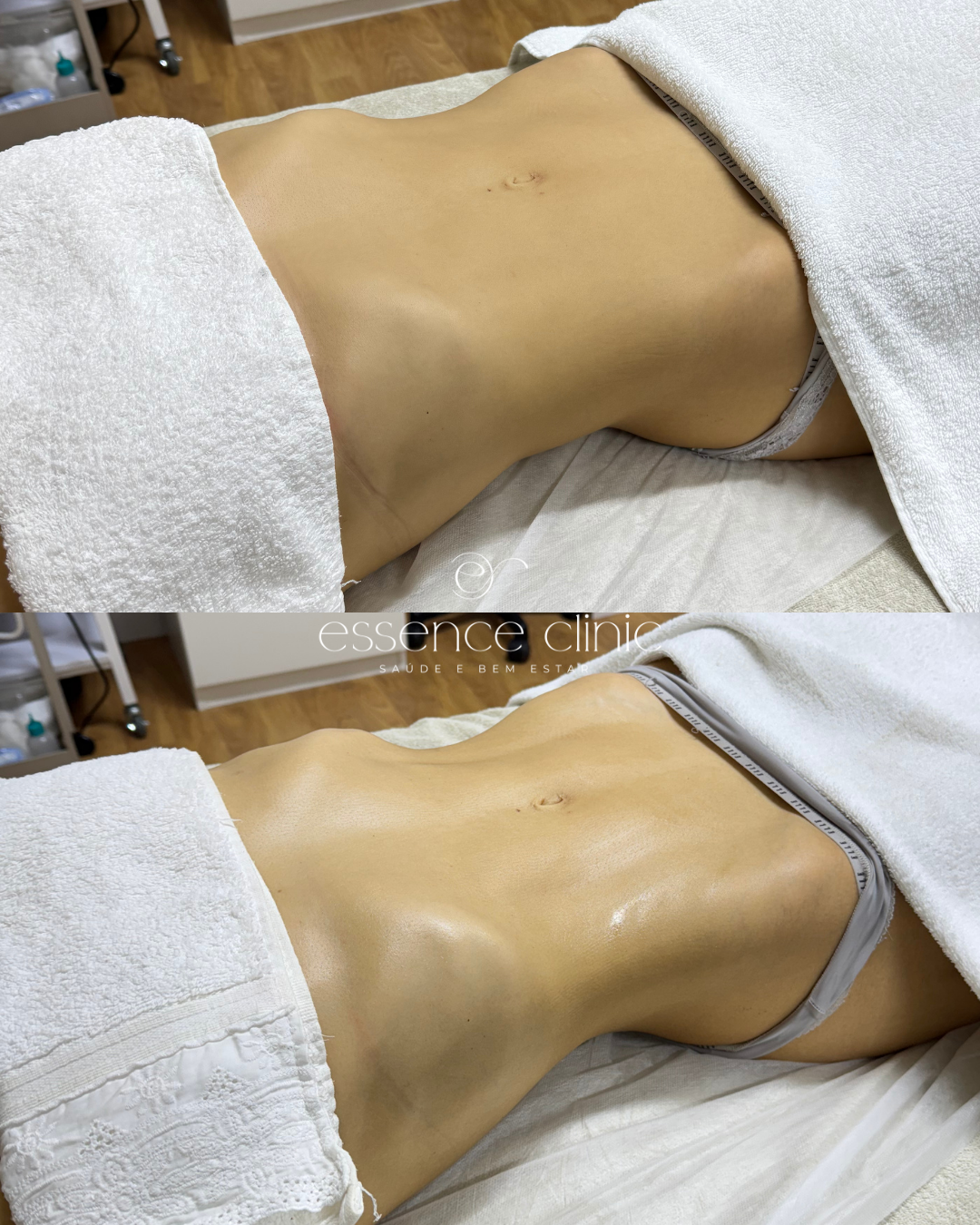 Antes e depois — caso 25