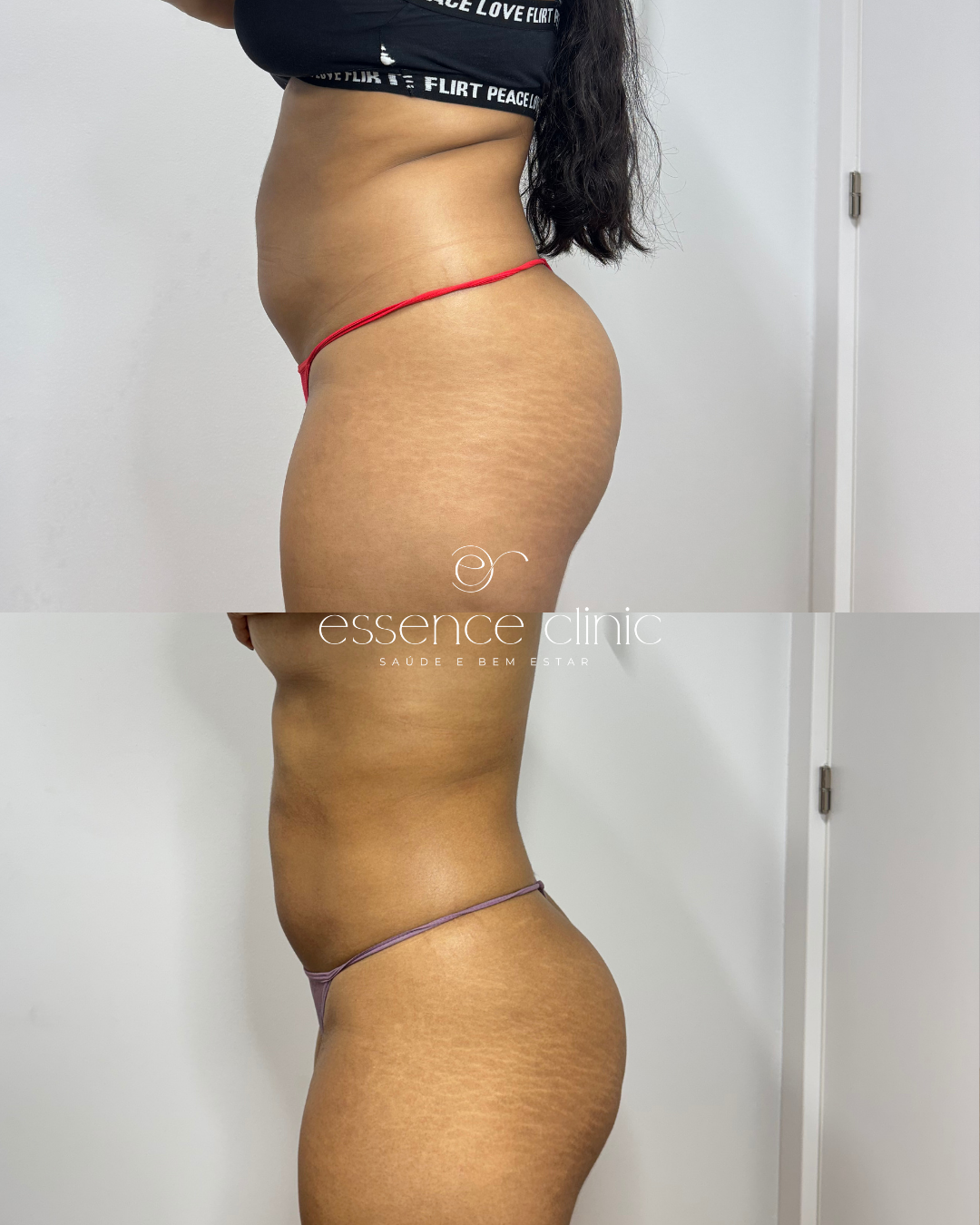 Antes e depois — caso 26