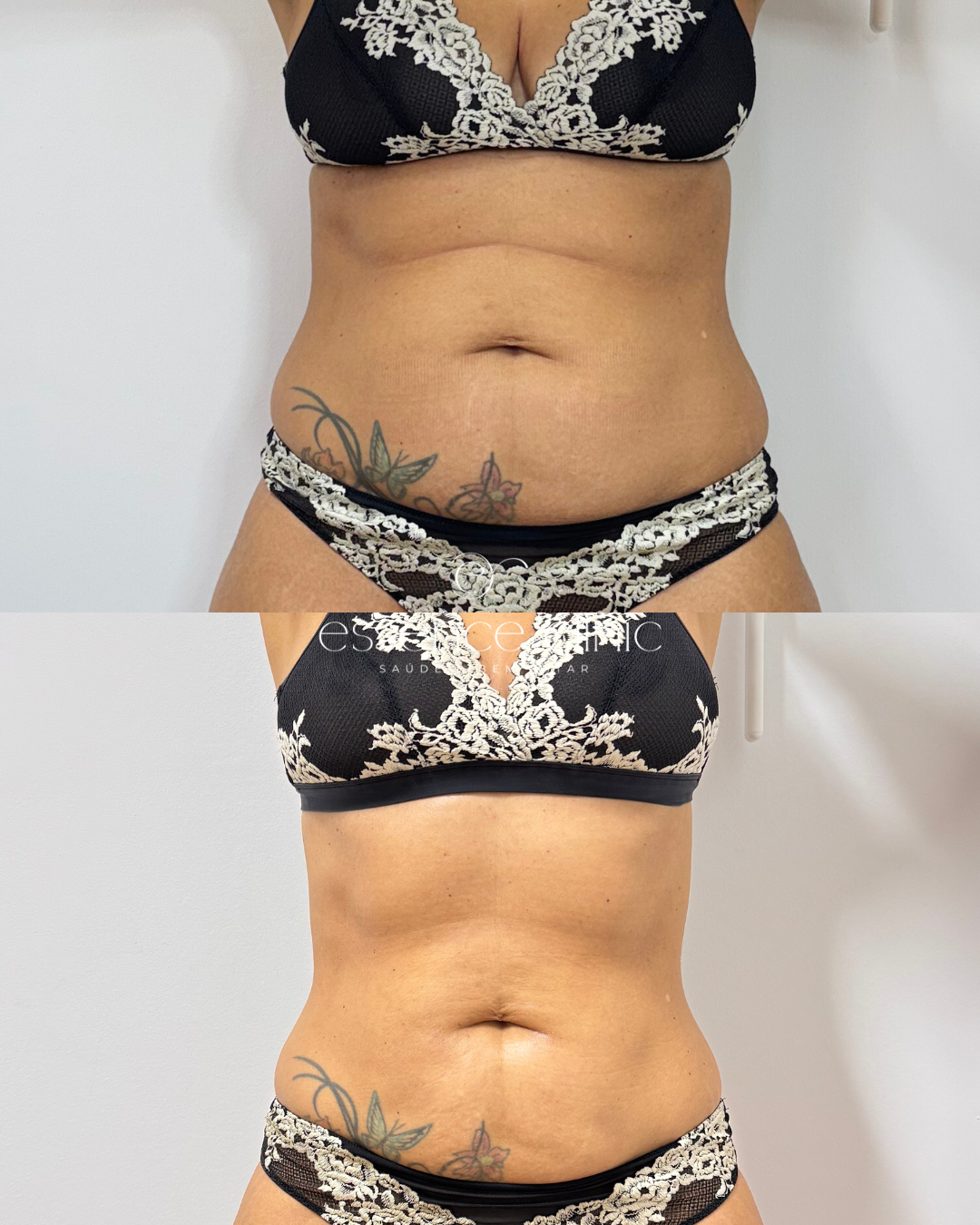 Antes e depois — caso 2