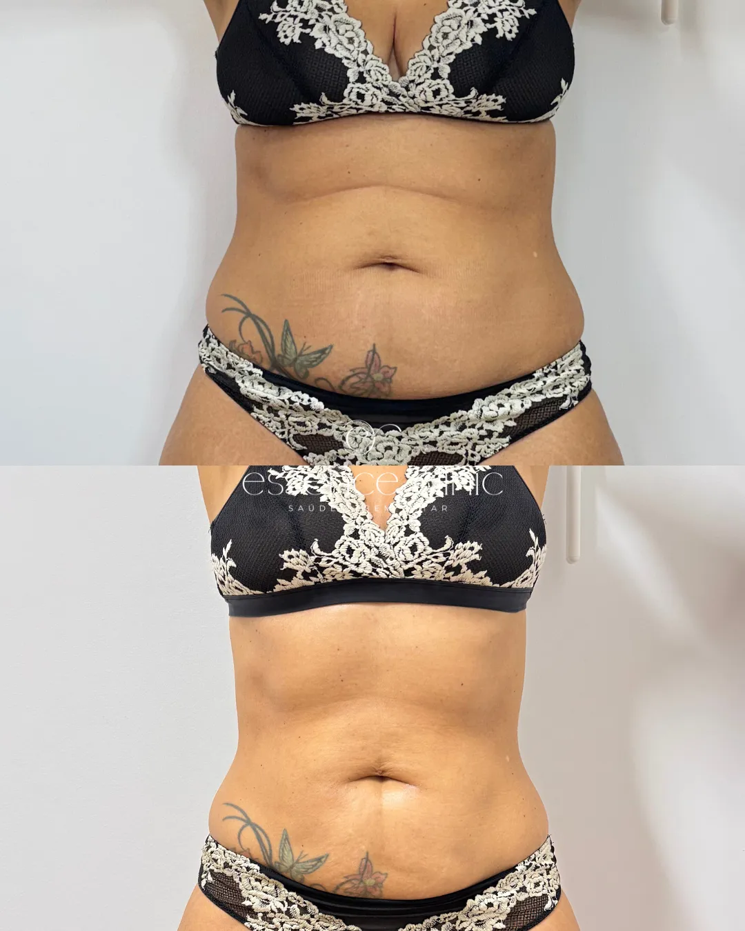Antes e depois — caso 2
