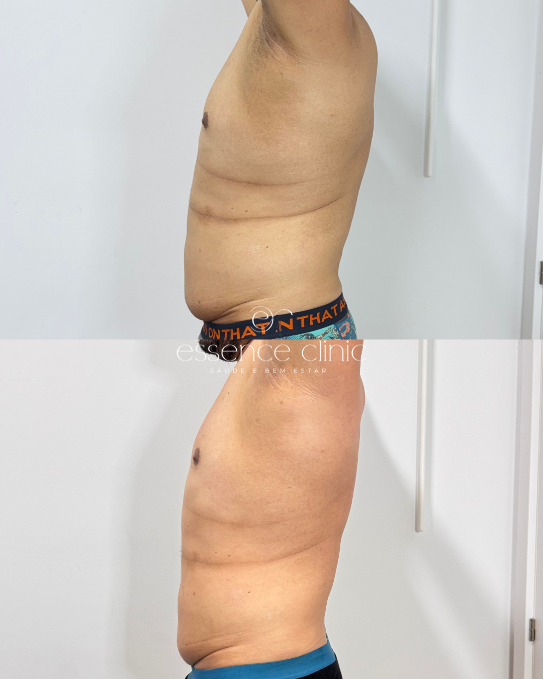 Antes e depois — caso 3