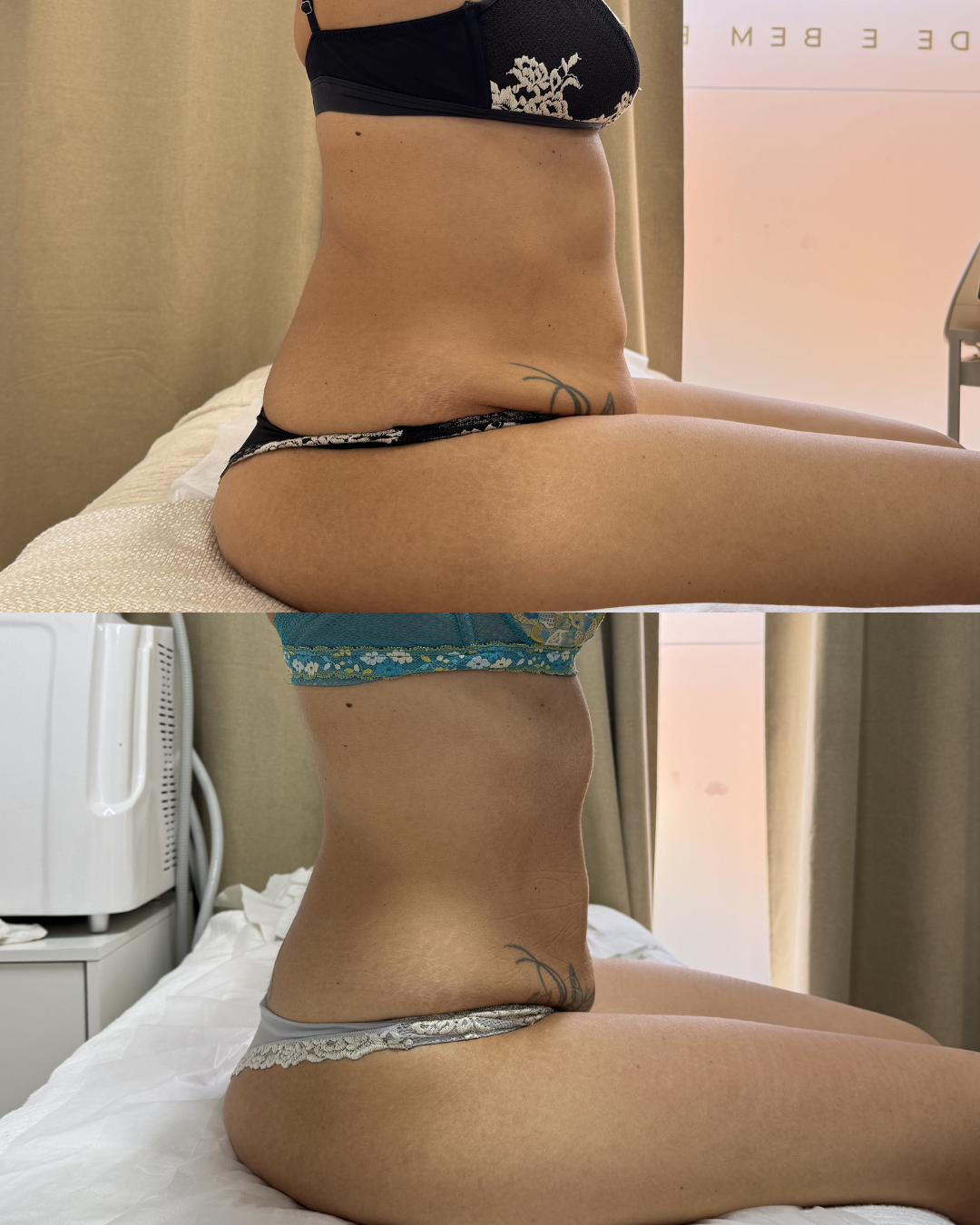 Antes e depois — caso 6