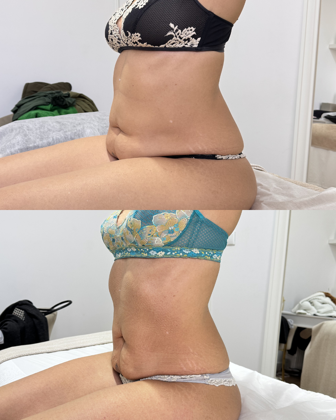 Antes e depois — caso 7