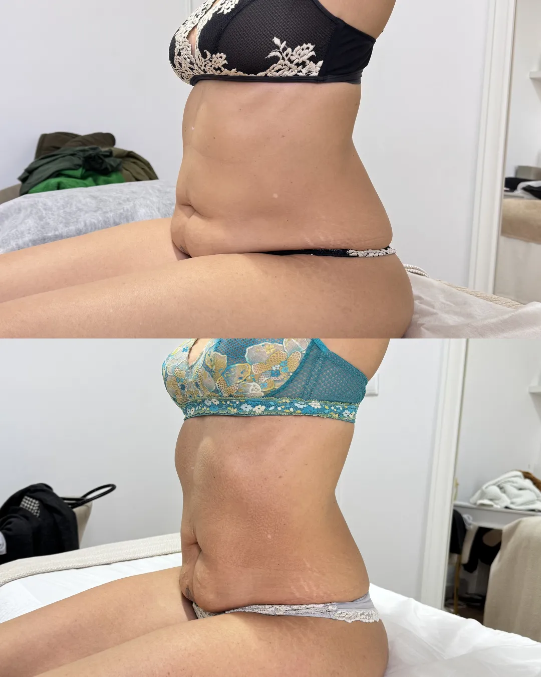 Antes e depois — caso 7