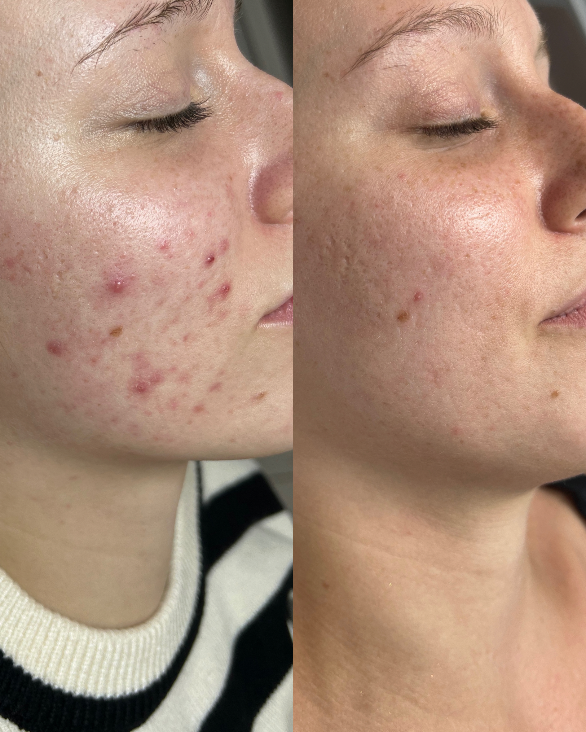 Antes e depois — caso 8