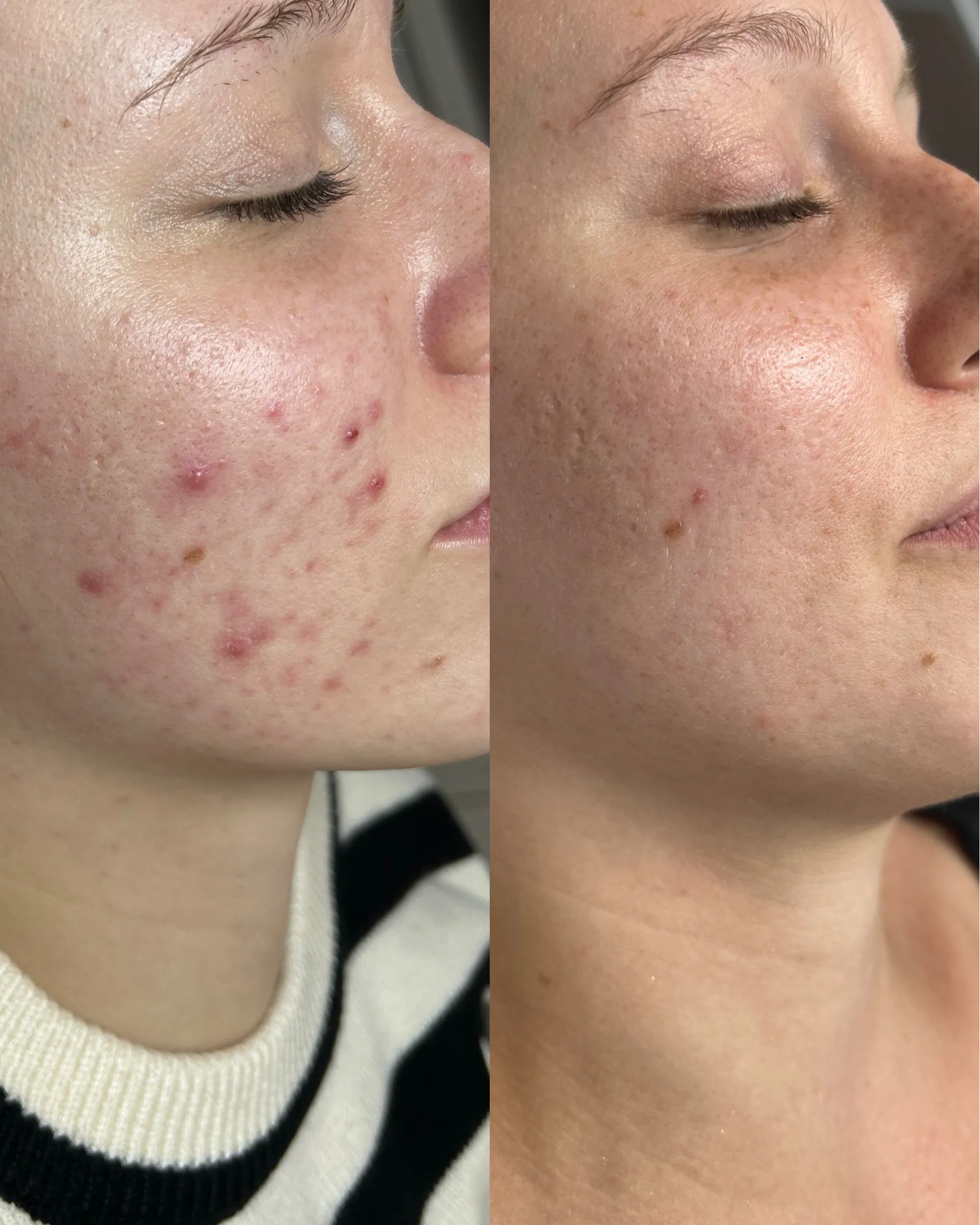 Antes e depois — caso 8