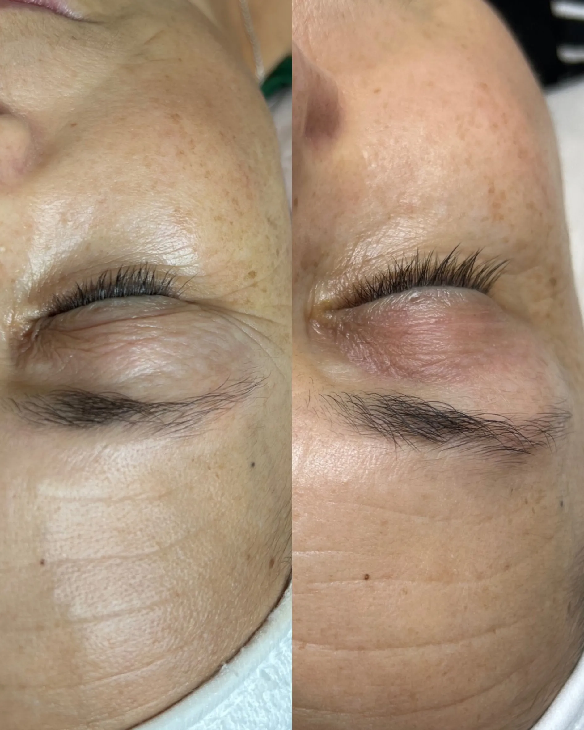 Antes e depois — caso 9